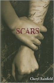 Scars